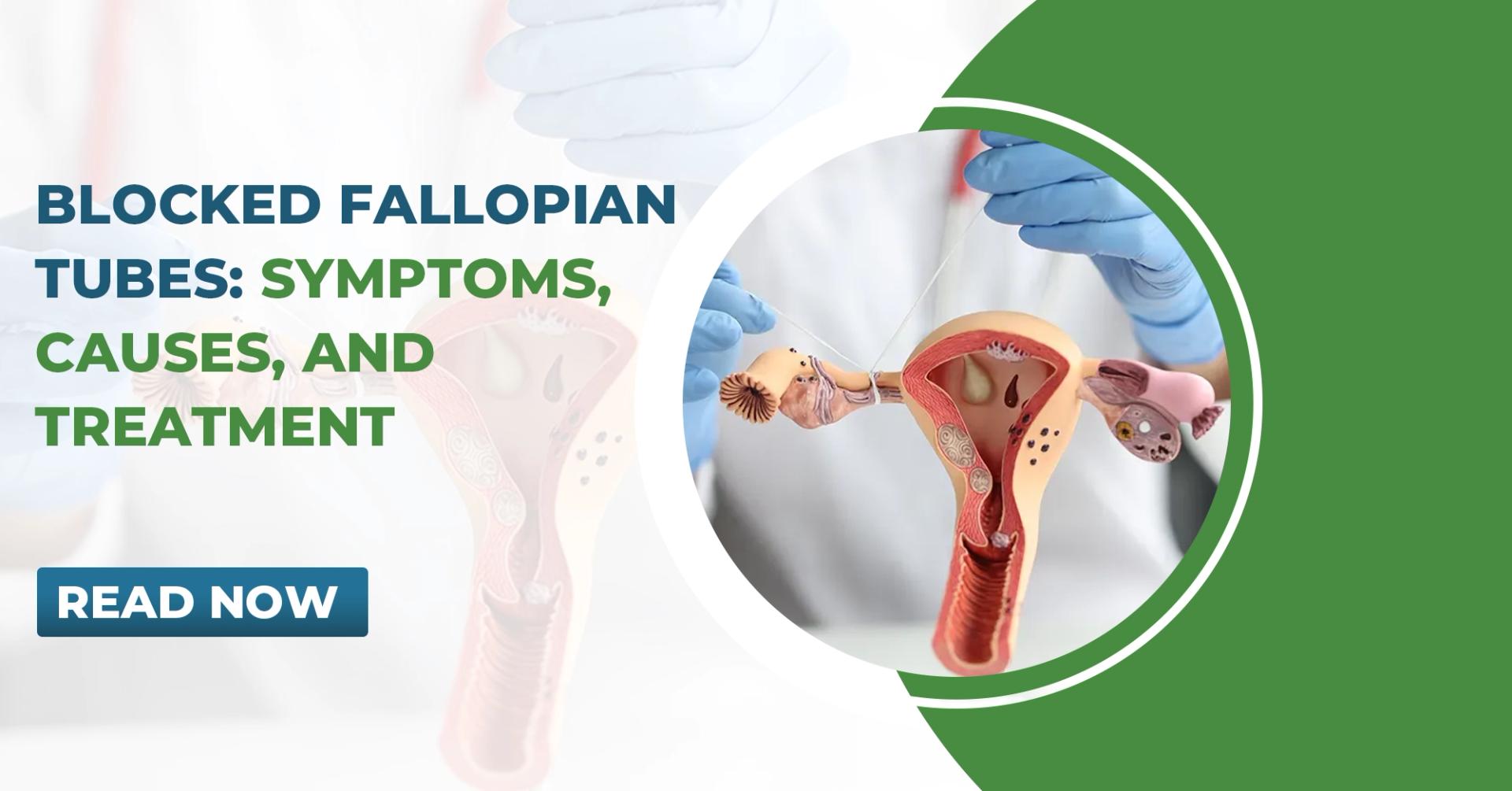 Blocked Fallopian Tubes: Symptoms, Causes, and Treatment